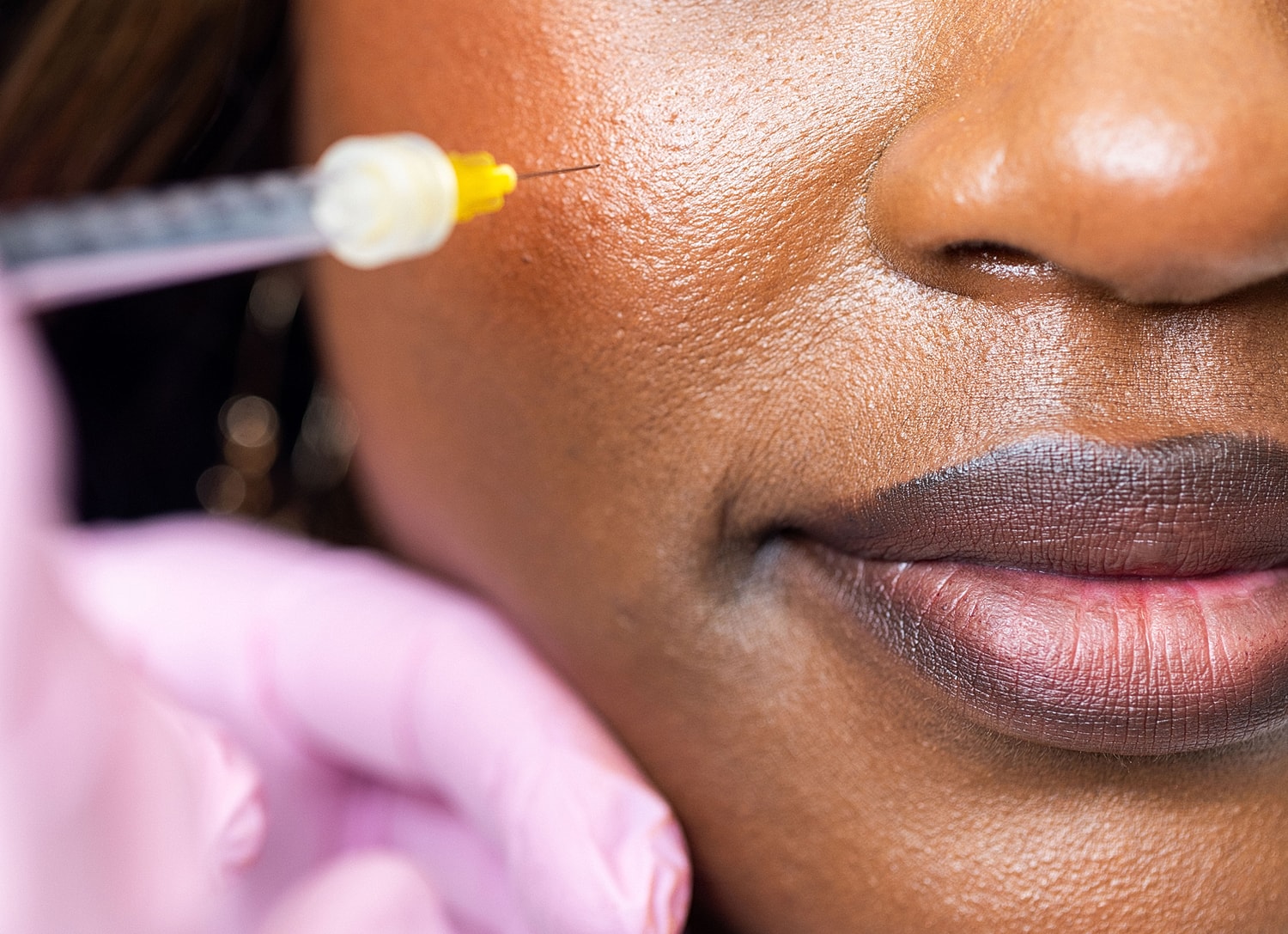 Injection being administered on a woman's face.