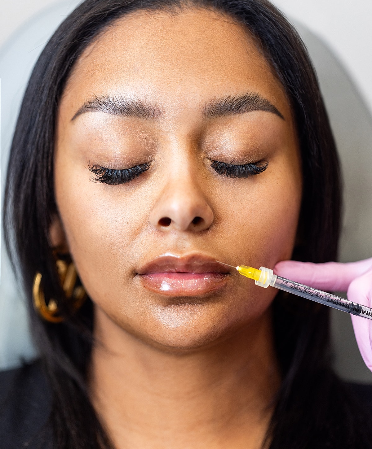 Lip treatment procedure with syringe and serum.