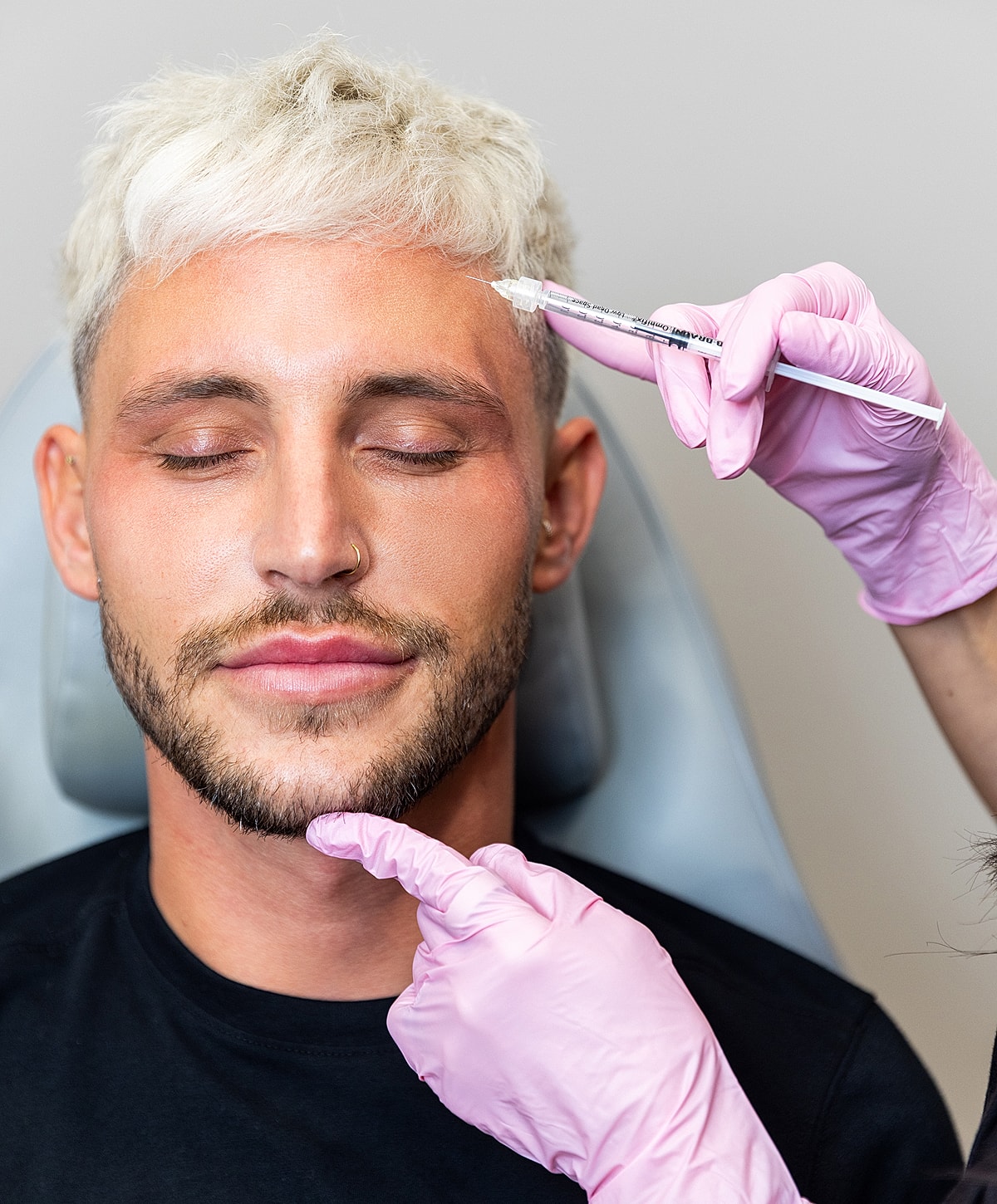 Injecting lip filler in cosmetic procedure session.