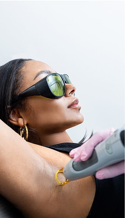 Laser hair removal session in progress.