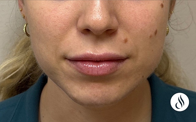 Close-up of a woman's lips and chin.