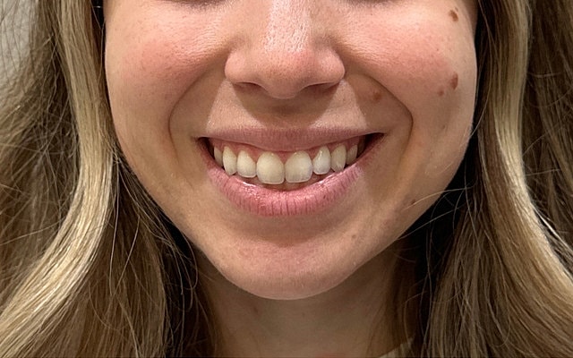 Close-up of a smiling woman's face.