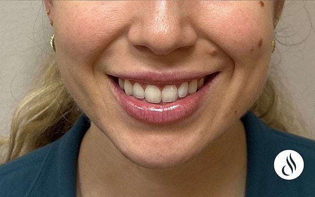 Smiling woman showing off her teeth.