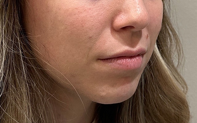 Close-up of a woman's face profile.