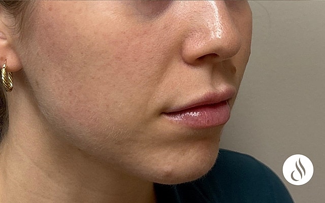 Close-up of woman's lips and cheek area.