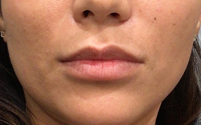 Close-up of lips and lower face.
