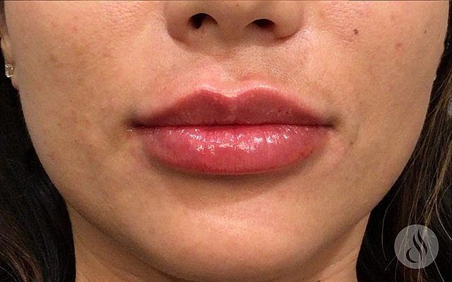 Close-up of glossy lips with natural appearance.