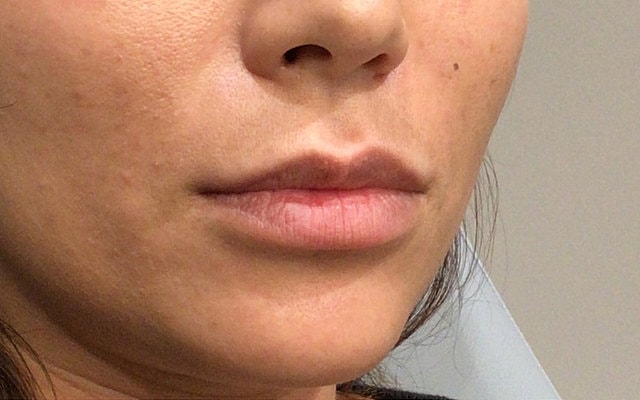 Close-up of a woman's lips and skin.