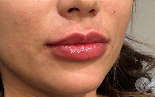Close-up of glossy, full lips.