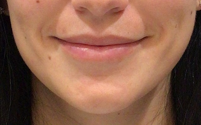 Close-up of a smiling mouth and chin.