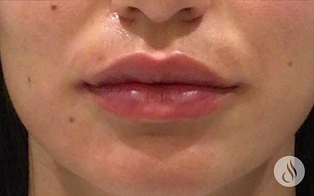 Close-up of woman's lips and lower face.