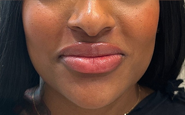 Close-up of woman's lips and chin.