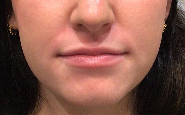Close-up of a person's lips and chin.