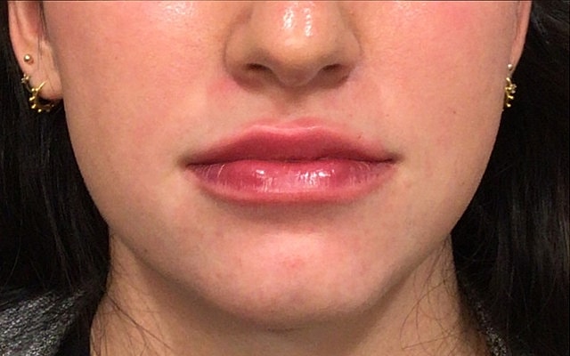Woman's lips with glossy finish and earrings.