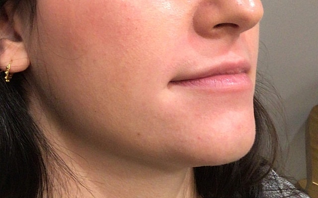 Profile view of a person's face and jawline.