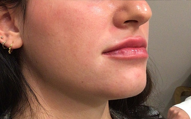 Close-up of a woman's lips and jawline.