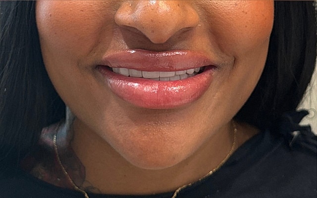 Close-up of smiling lips with glossy finish.