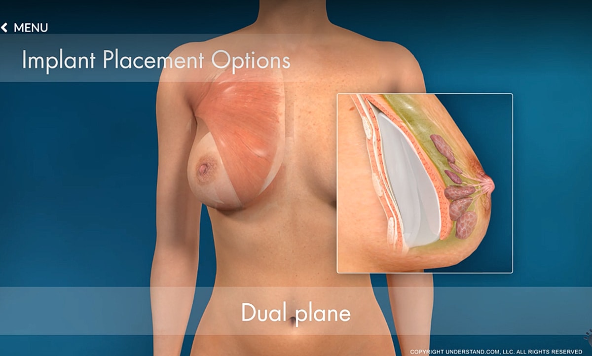Anatomical diagram of human breast structure.
