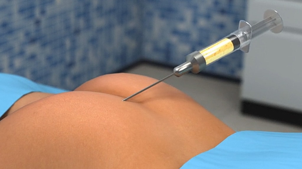 Syringe injection in a medical setting.